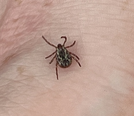 An American dog tick on a persons arm An American dog tick on a persons arm